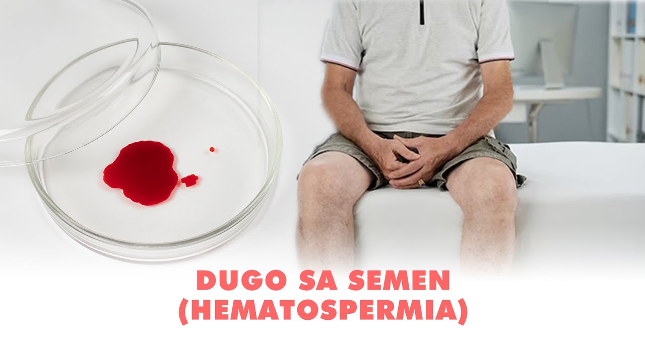 [Q&A] SANHI NG DUGO SA SEMEN (HEMATOSPERMIA | VITAMINS FOR TESTOSTERONE | SPIRULINA PARA SA PROSTATE