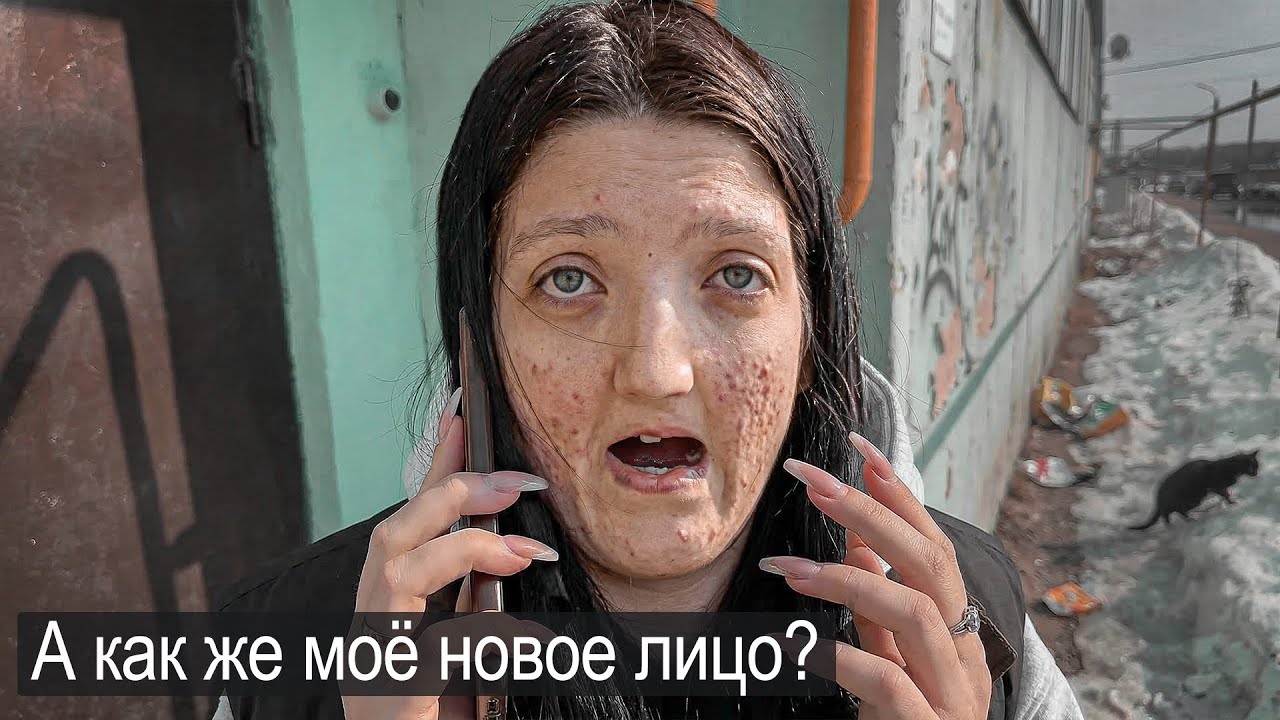 Я ЖДАЛА ДО 18 ЛЕТ ПЛАСТИЧЕСКУЮ ОПЕРАЦИЮ И МЕНЯ ОБМАНУЛИ.