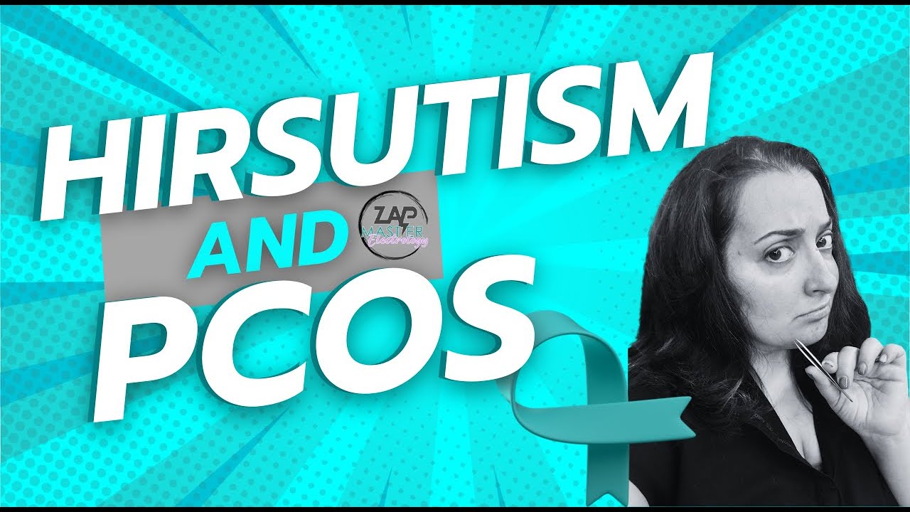 Hirsutism and PCOS