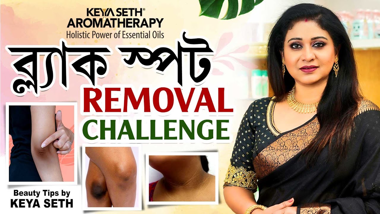 Get spotless skin before Puja | পুজোর আগেই পাও দাগমুক্ত ত্বক | #KeyaSetharomatherapy  #KeyaSeth