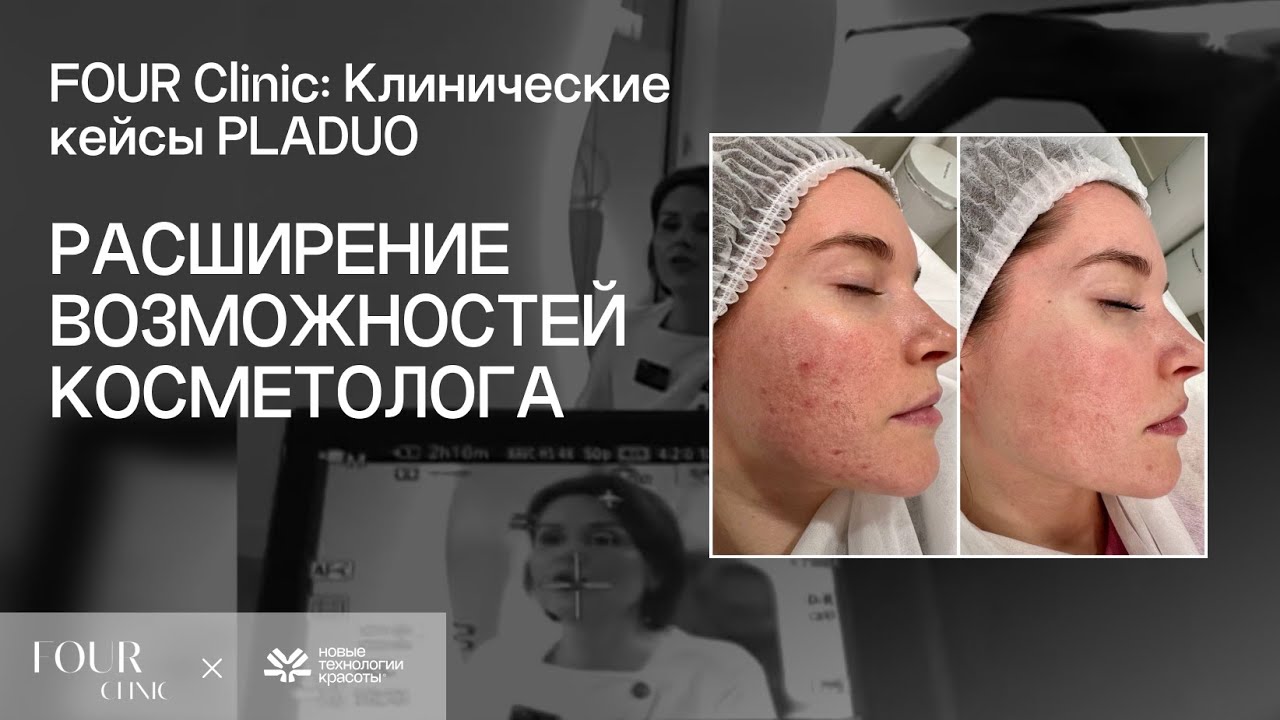 Кейсы, которые всё доказали: PLADUO в сложных дерматологических случаях