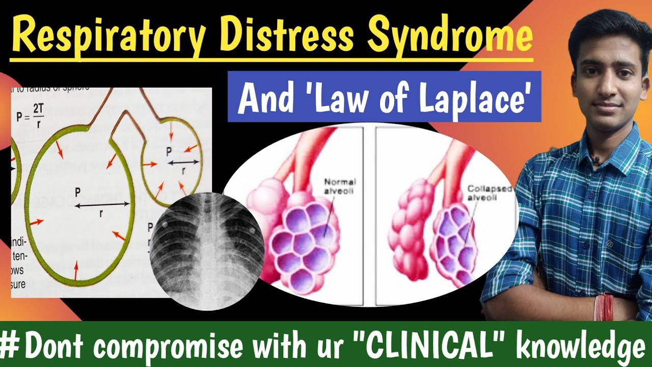 Respiratory Distress Syndrome || Law of Laplace || Respiratory Physiology|| hindi|| Ashish