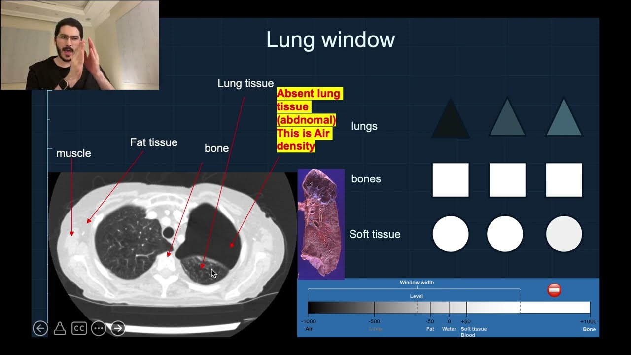 Part-3 Basic radiology course (CT Scan) arabic