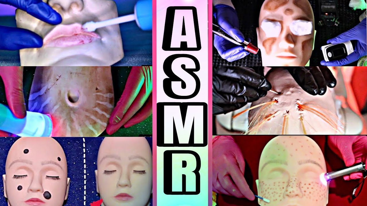 ASMR CLÍNICA DE ESTÉTICA:remoção de sardas,estrias,vitiligo,transplante capilar,microagulhamento