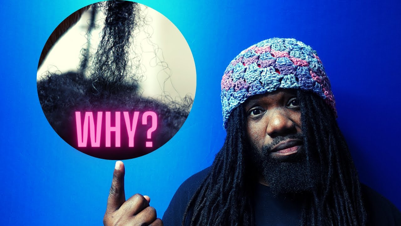 Thinning Dreadlocks!! | What to Do if You Have Hair That Grows AWAY from your Locs!