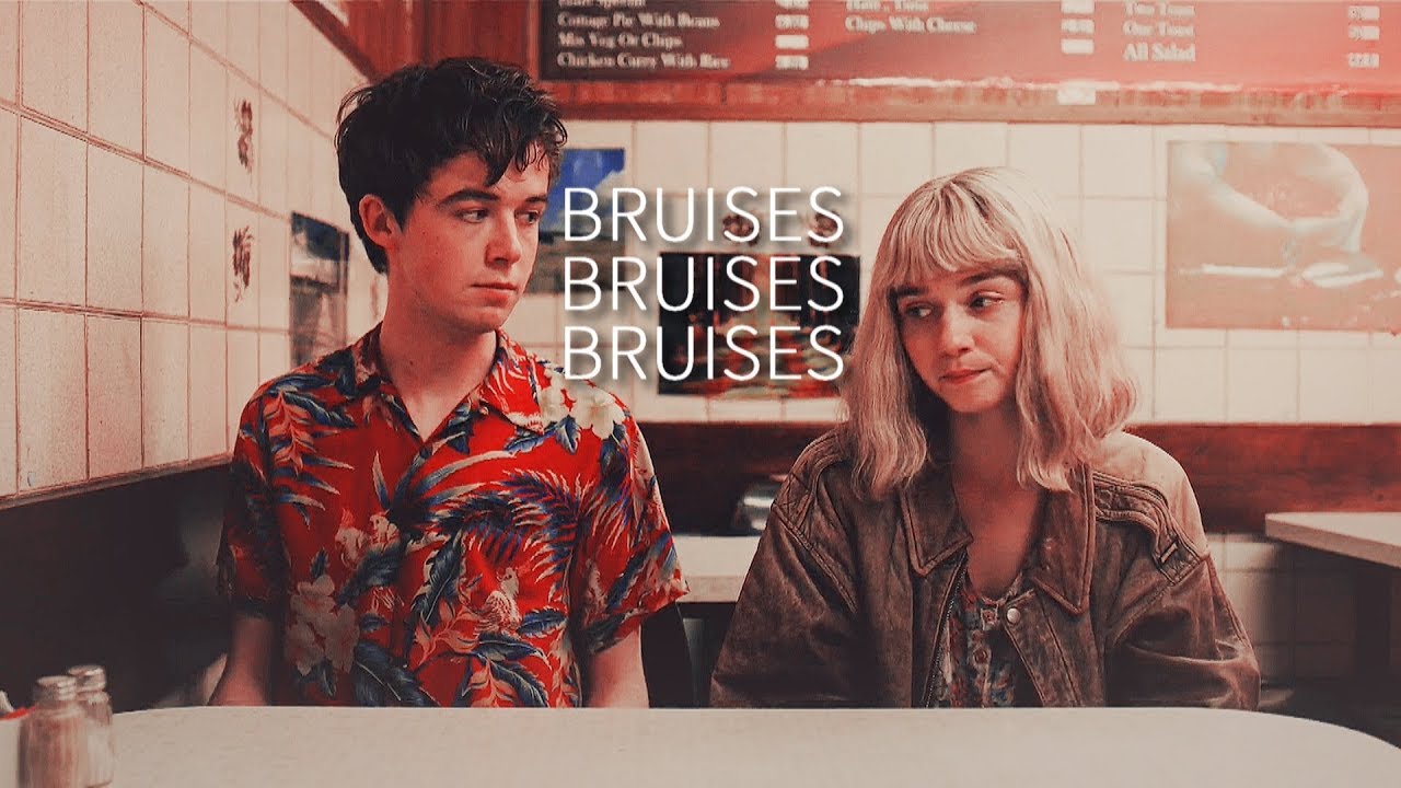 James & Alyssa | Bruises