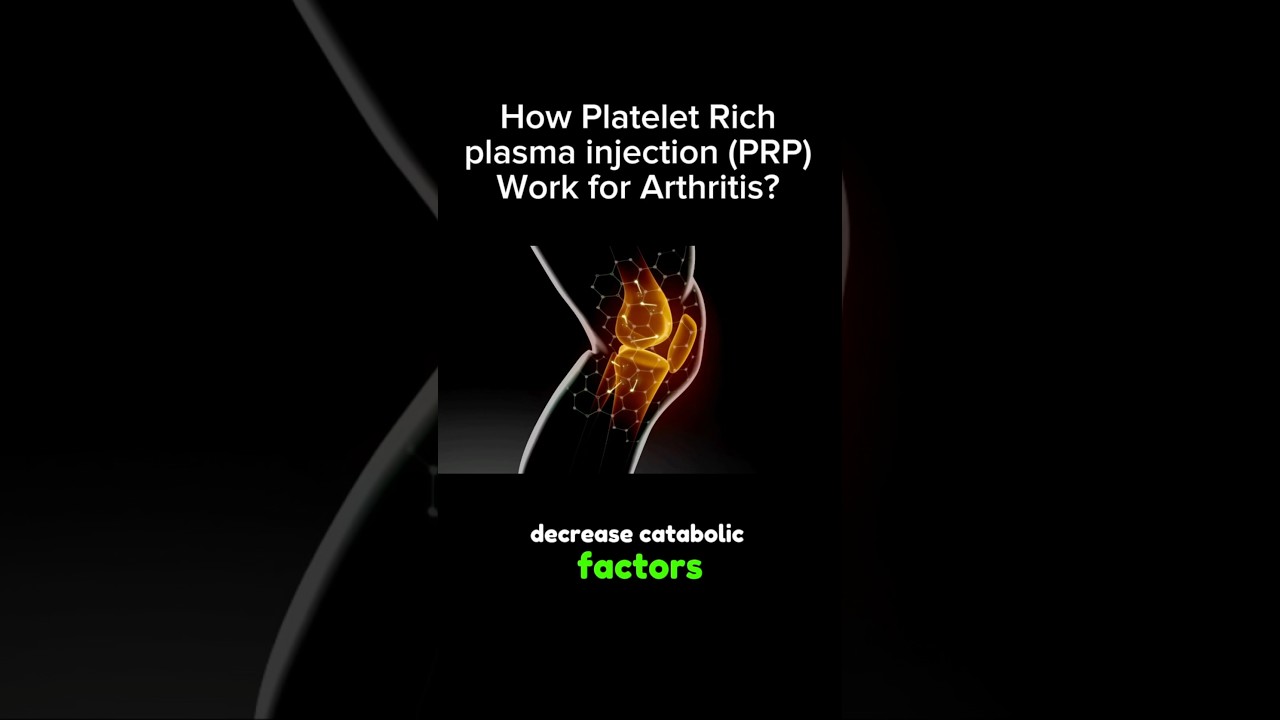 How PRP Injections Help Knee OsteoArthritis #shorts #kneeosteoarthritis
