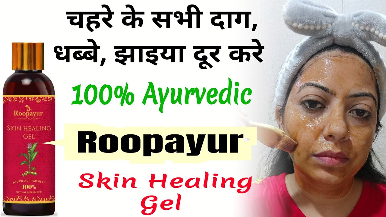 How to use Roopayur skin healing gel || Reduce pimples, pigmentation, hyperpigmentation, dark spots