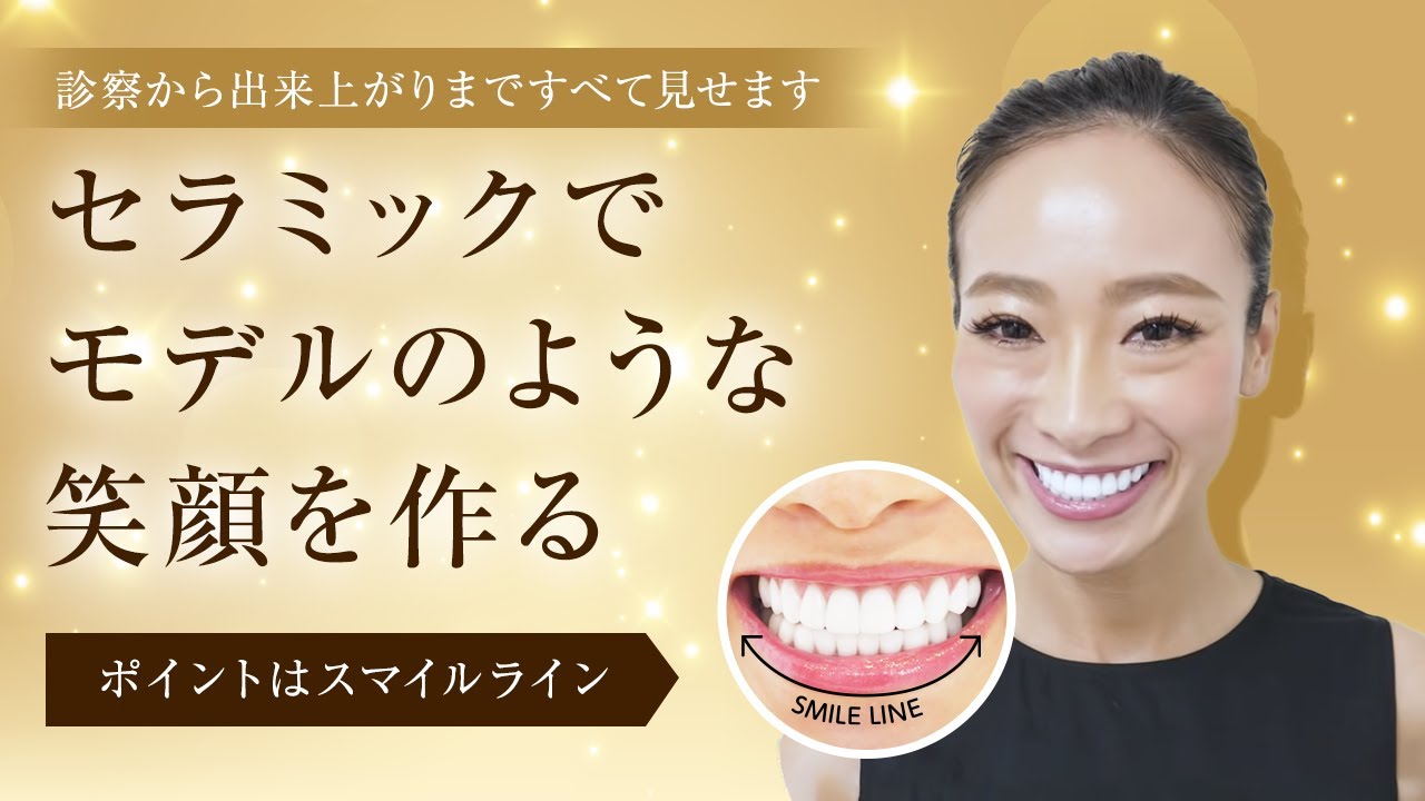 【セラミック矯正】モデルのような白い歯・歯並びに！診察から出来上がりまでの過程を全て見せます。メリットが良く分かる！【湘南美容クリニック】