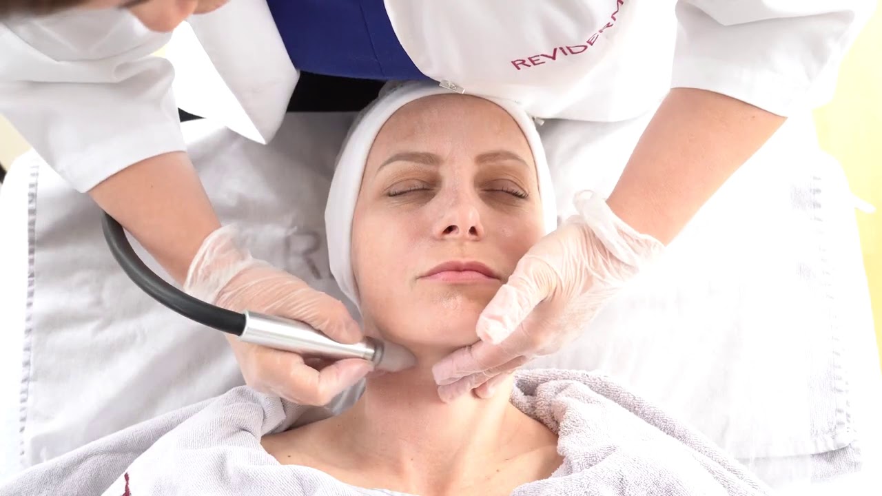 REVIDERM mikrodermoabrazija - Skin peeler new generation