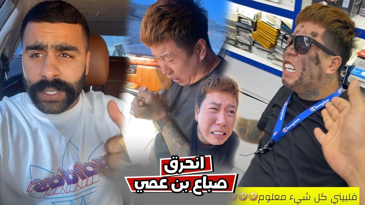 بوشنب بن عمي صباعه انحرق بسبب الي صار