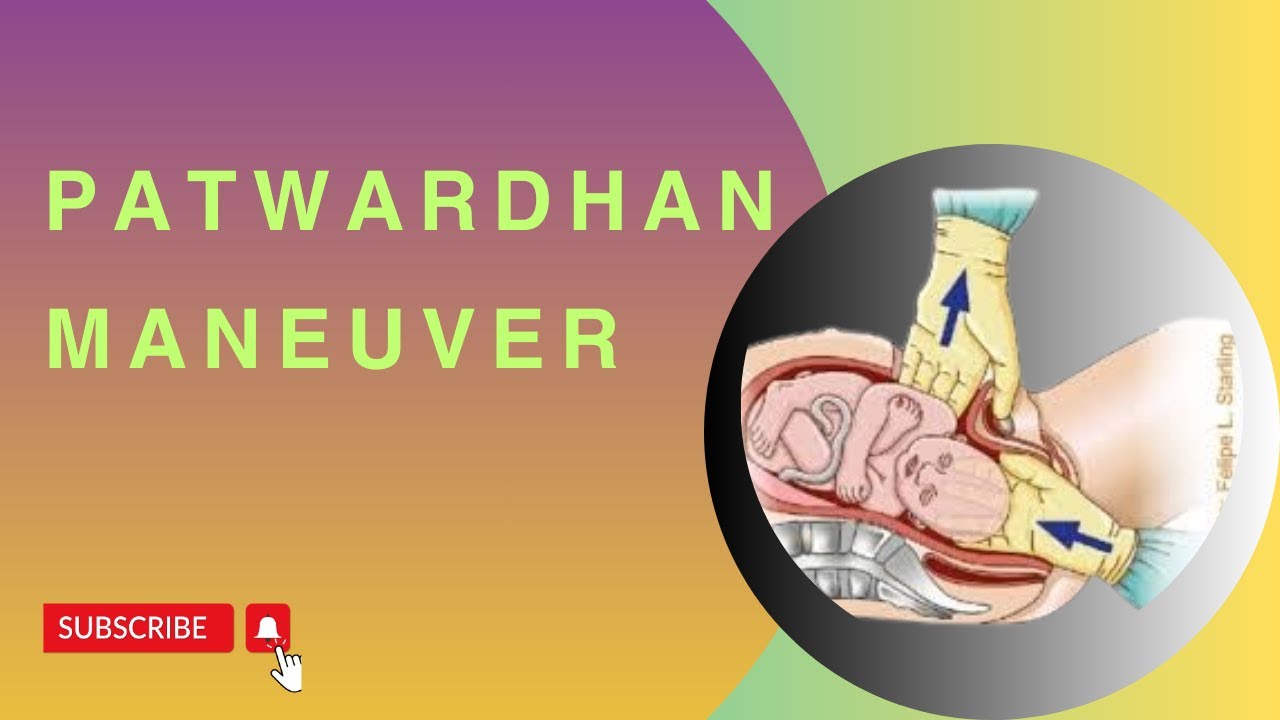 Маневр Патвардхана: техника при вклинении плеча в операционное поле во время кесарева сечения.