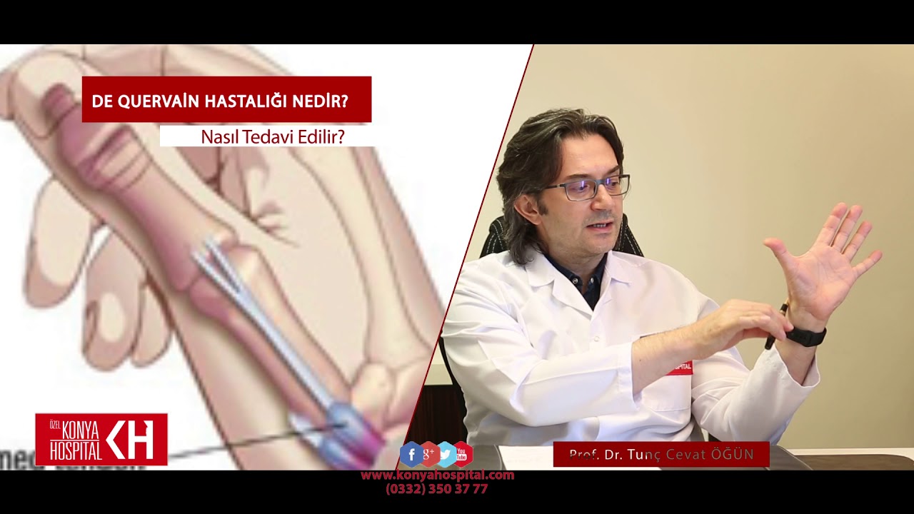13;de Quervain hastalığı Prof. Dr. Tun&ccedil; Cevat &Ouml;Ğ&Uuml;N - Ortopedi ve Travmatoloji