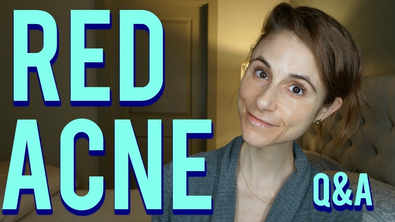 Red acne marks on the face: Q&A with a dermatologist|Dr Dray
