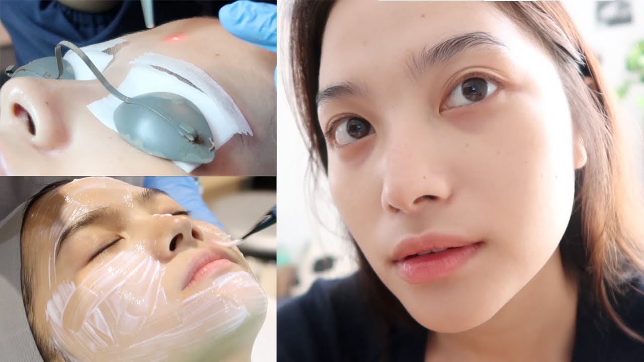 HOW CLINIC TREATMENTS HAS CHANGED MY SKIN