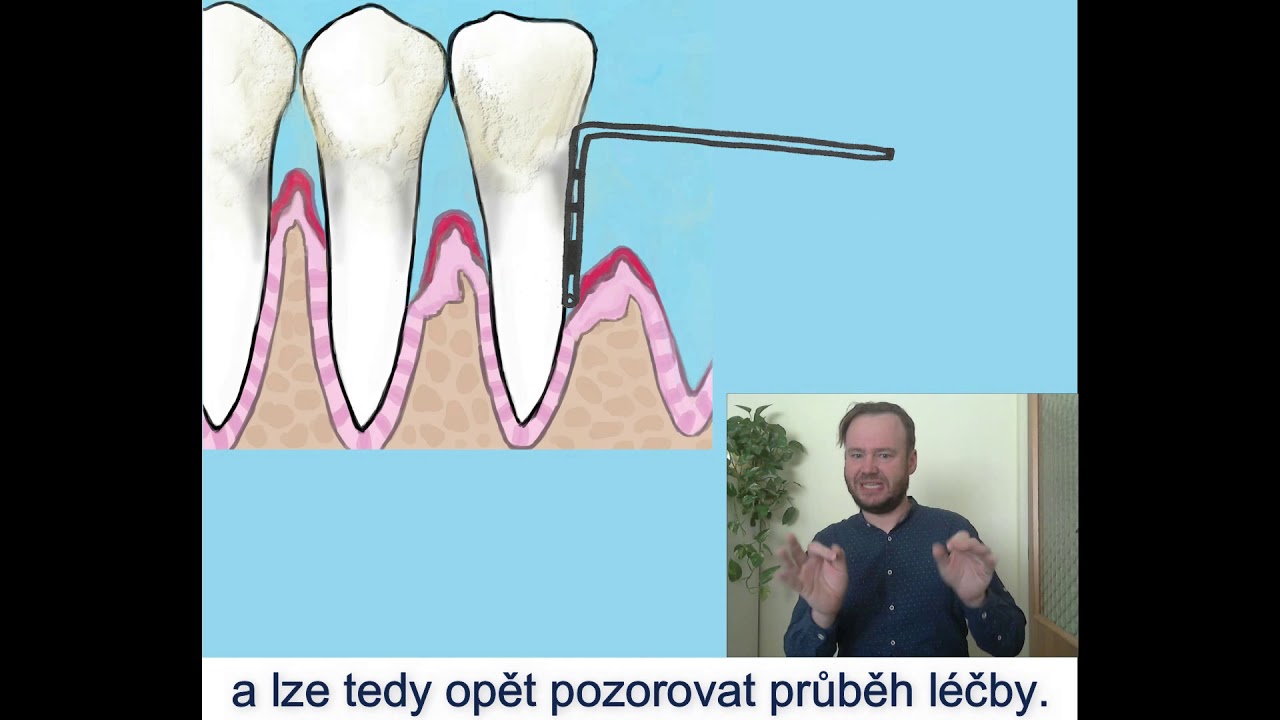Proč dodržovat správnou ústní hygienu?