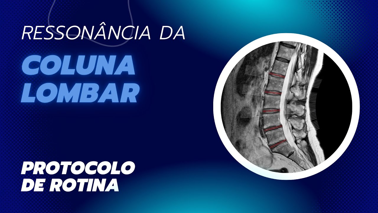 Planejamento de Exames em Ressonância Magnética