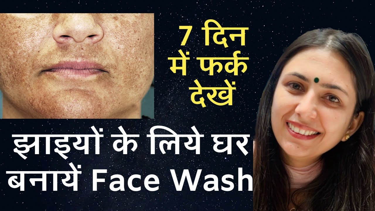 Jhaiyo ke liye homemade Facewash | 7 Days Melasma Pigmentation Melasma Challenge | Dr. Upasana Vohra
