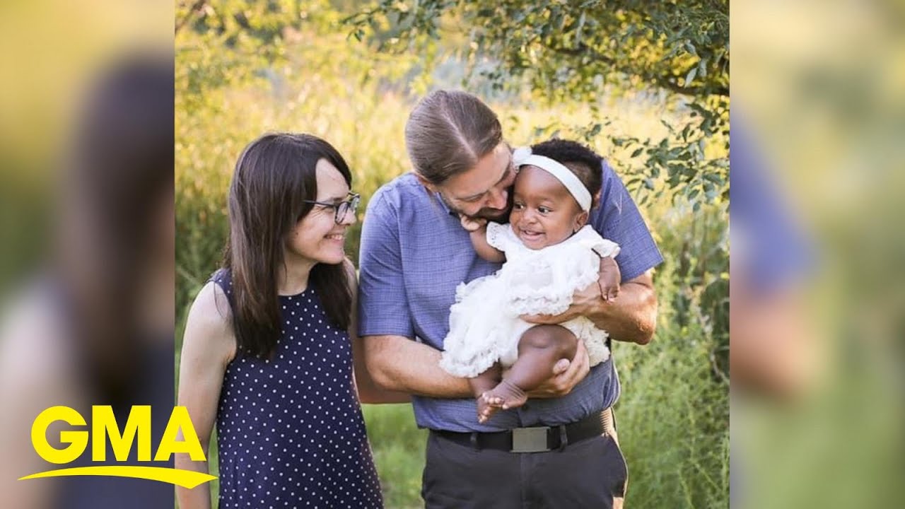 Father who lived with a physical difference bonds with daughter who has her own | GMA