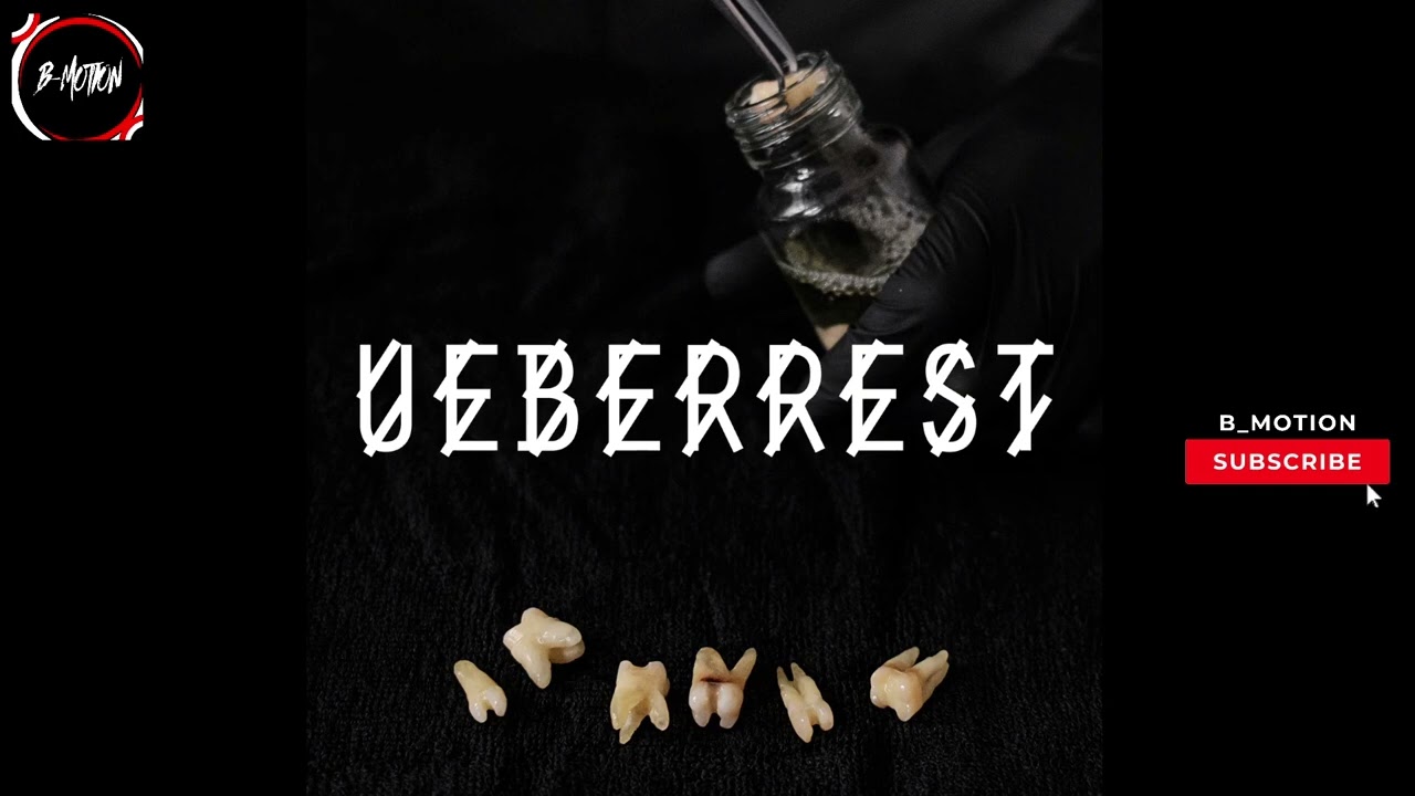 All You Want Original Mix /Ueberrest /