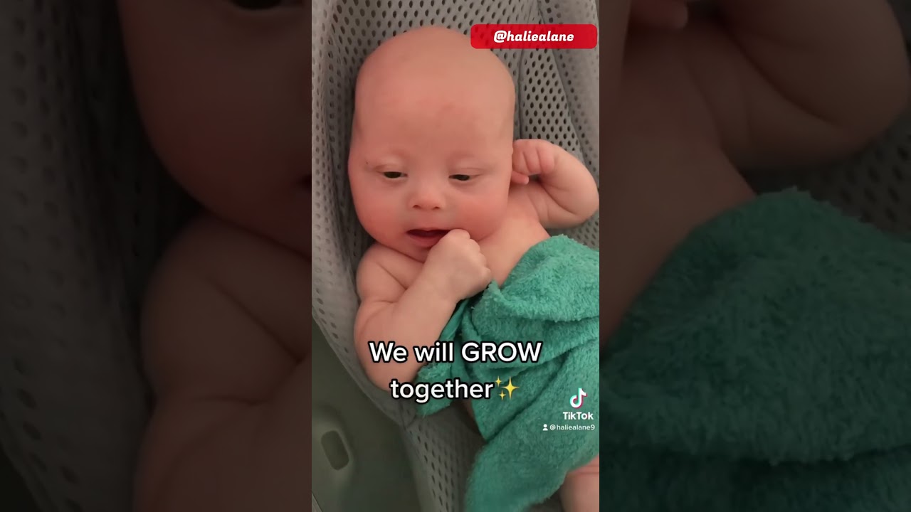 👶A Bond Like No Other! #babies #cute #downsyndrome #parenting