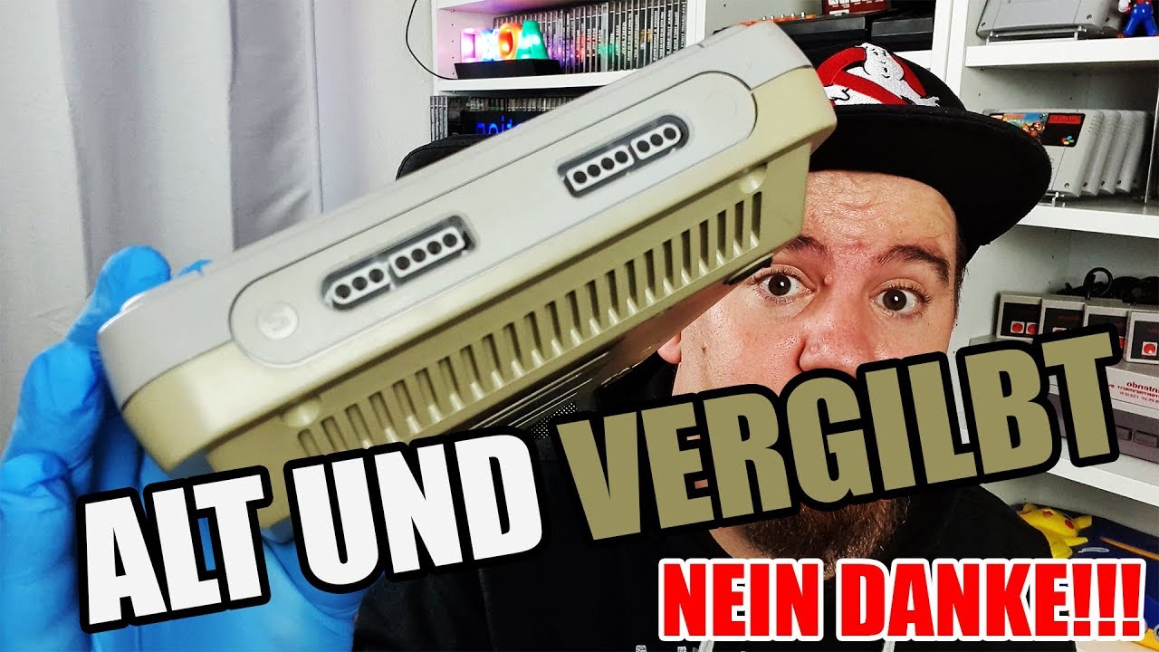 So werde ich meine Vergilbungen los! - Schnell repariert #3