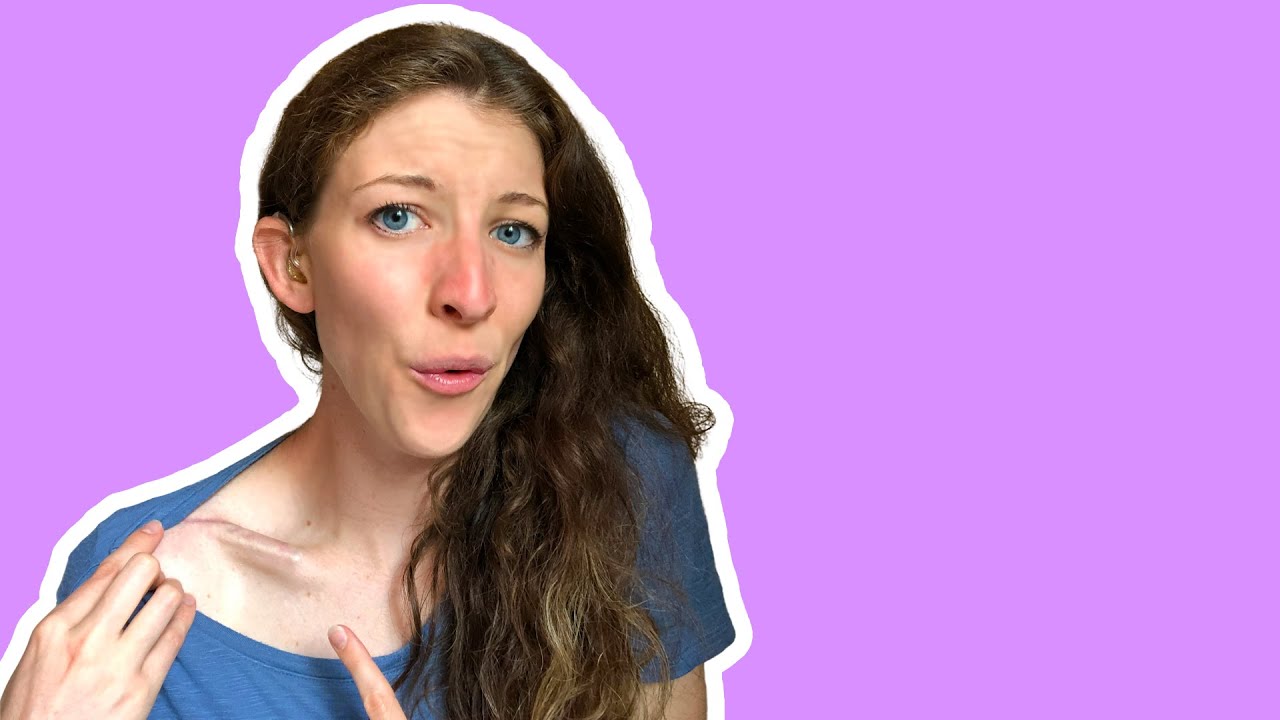 Clavicle Injury and Recovery Update