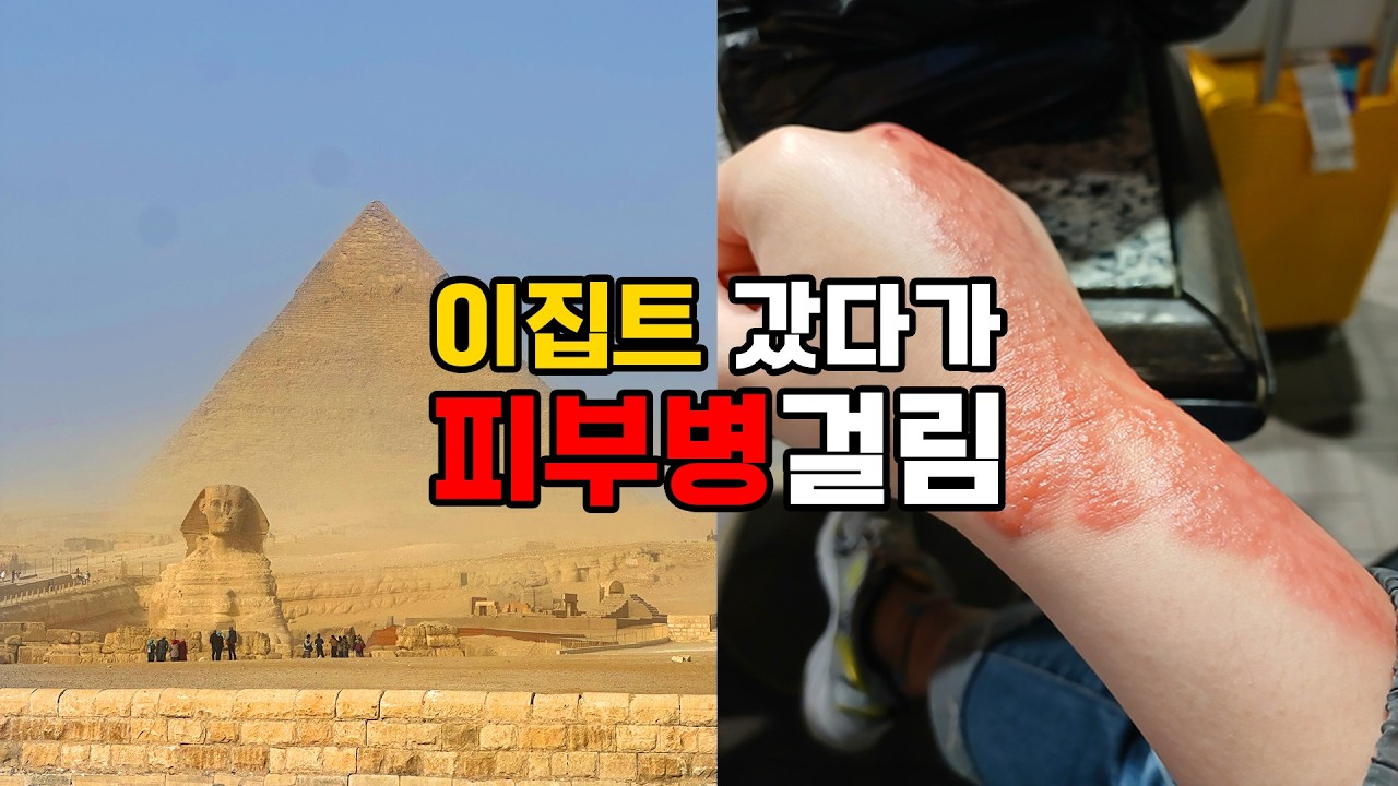 이집트에 장사하러 갔다가 생긴일