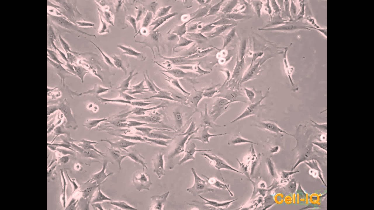 Nanovector-based prolyl hydroxylase domain 2 silencing system - Video S1  [ID 71586]