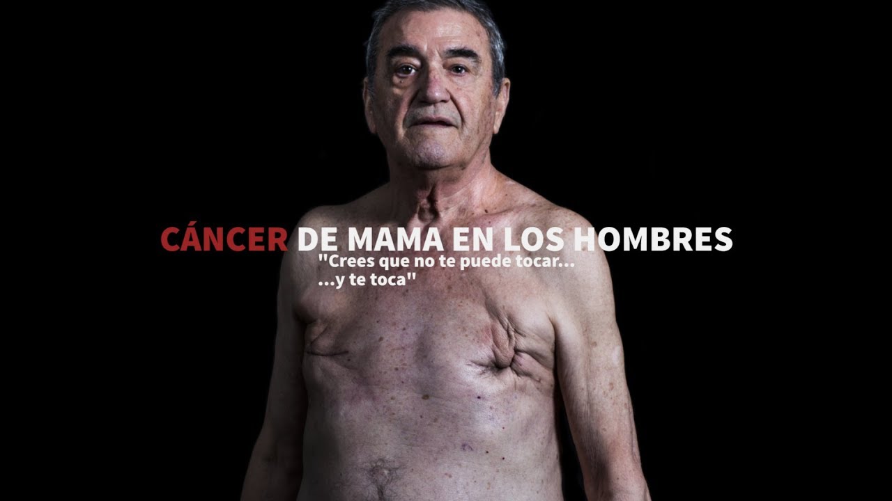 Cáncer de mama en los hombres