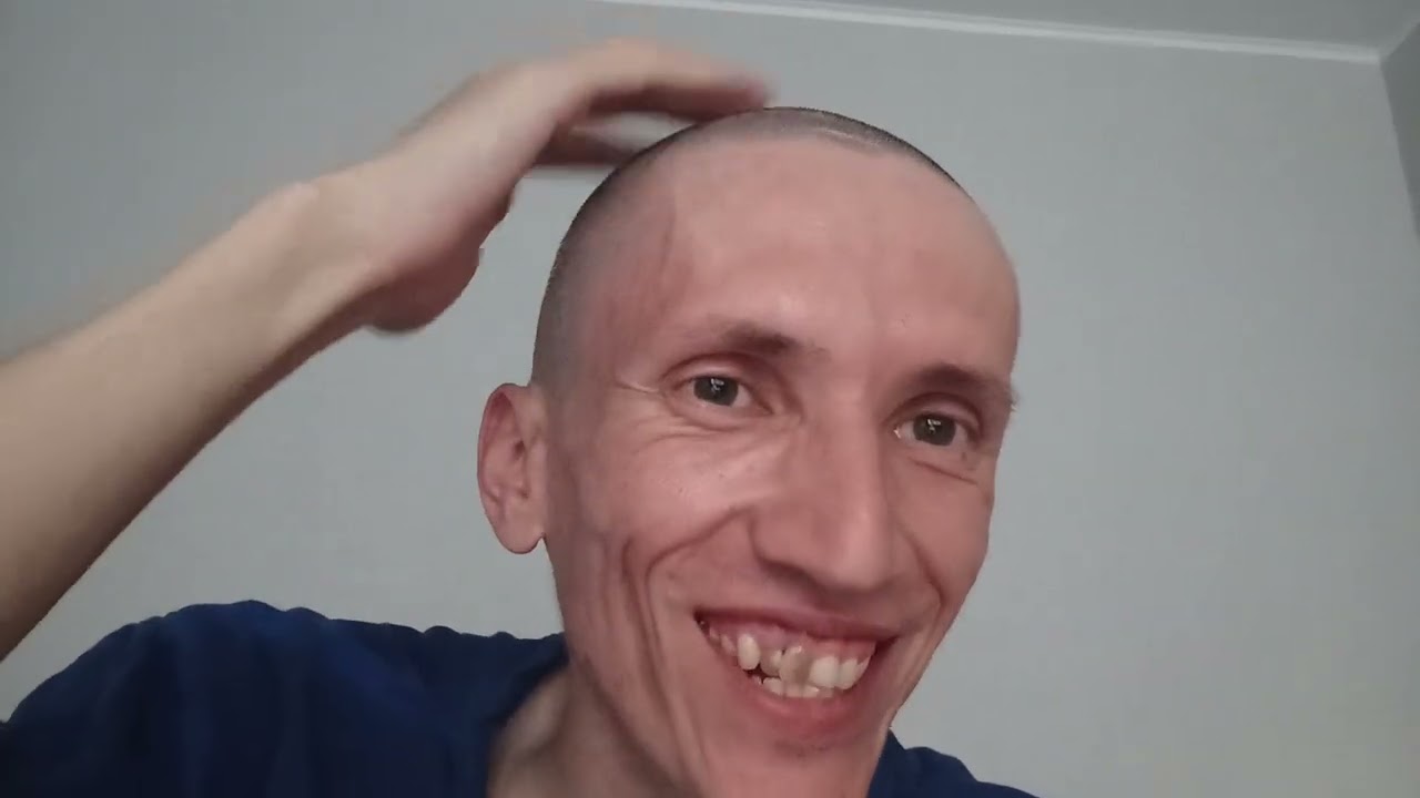 Я побрился налысо