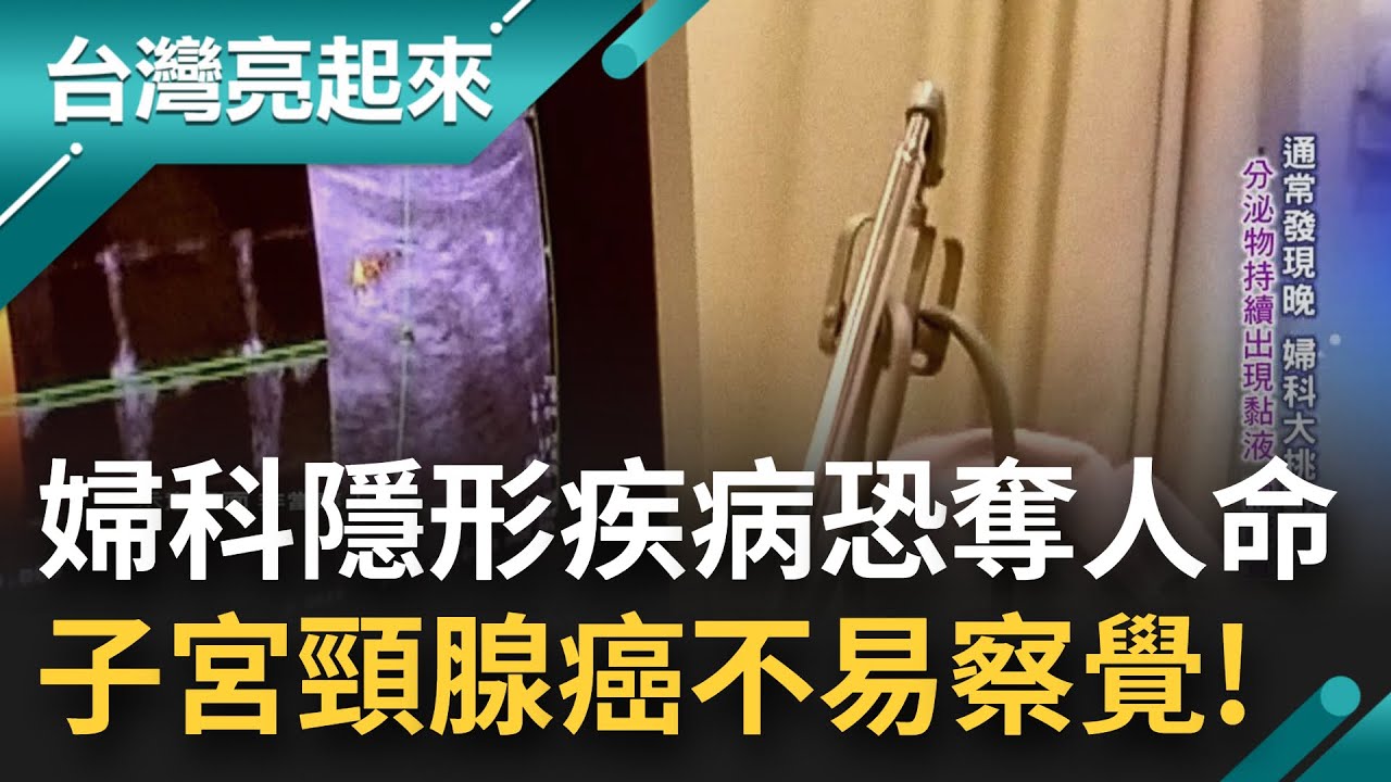 沉默殺手要小心! 子宮頸腺癌威脅女性健康 做抹片6分鐘護一生能預防? 醫生解密:腺癌細胞難分辨 發生在子宮頸內口不易採樣｜記者 李心嵐 朱怡寧｜【台灣亮起來】20220901｜三立新聞台