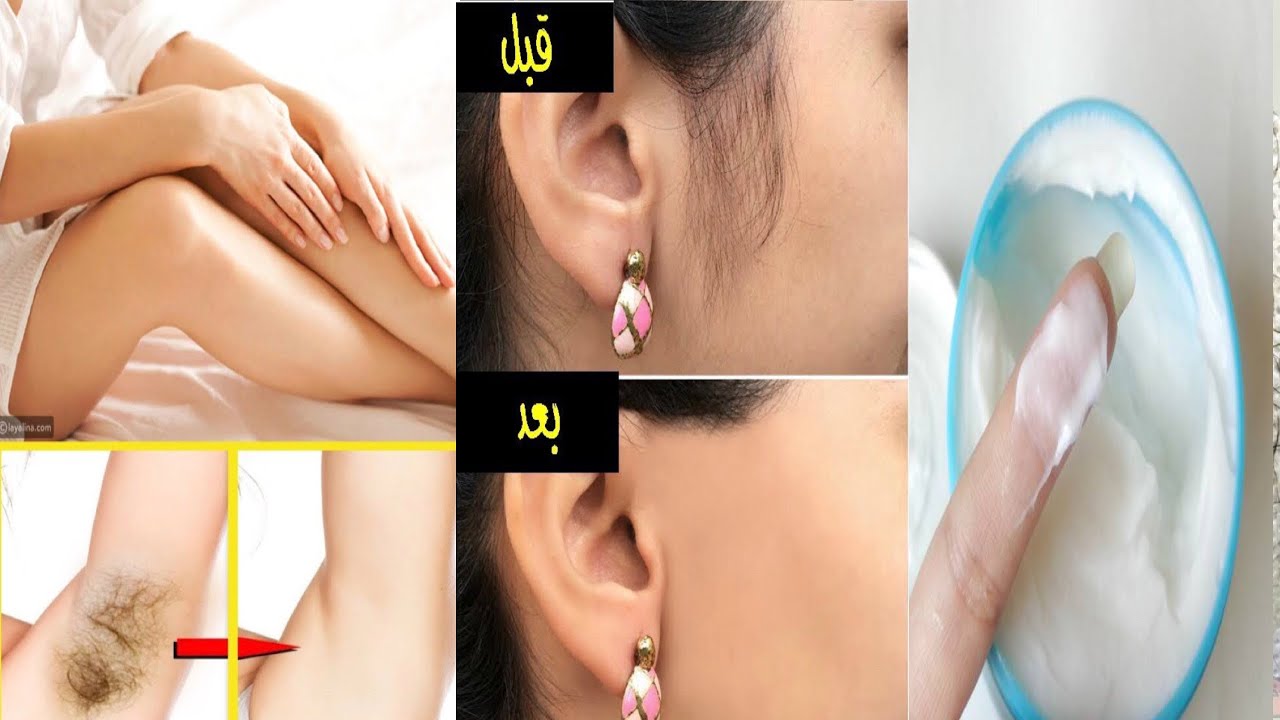 بمكونات من بيتك اصنعي كريم لازالة الشعر نهائيا بديل الليزر