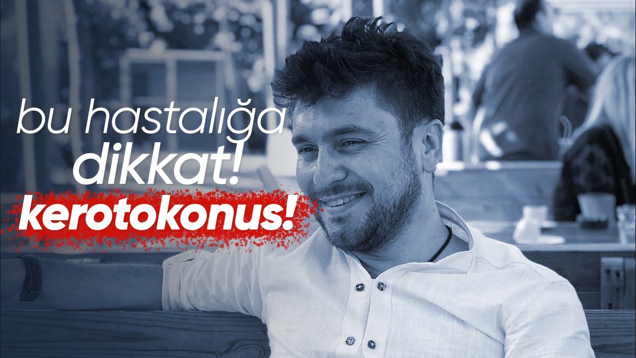 Keratokonus Hikayemi İzlemeden Tedaviye Başlamayın
