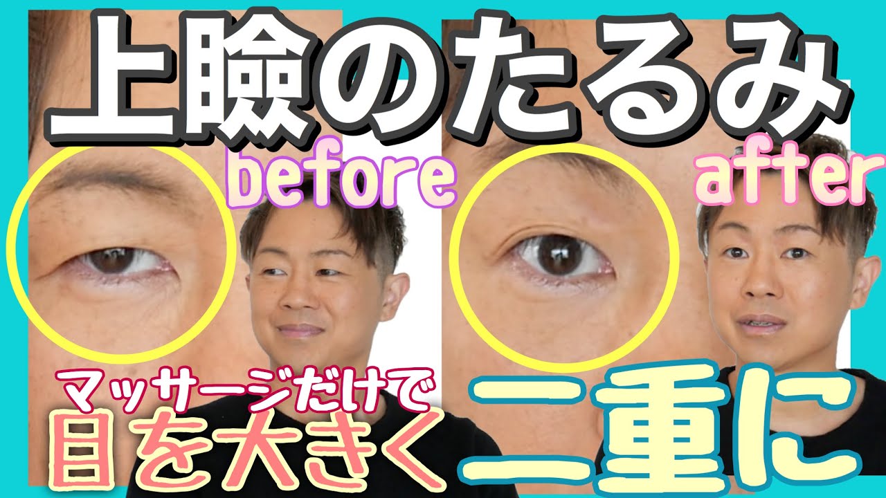 【たった2分で整形級】目を大きくする！上瞼のたるみはシワの原因になります！