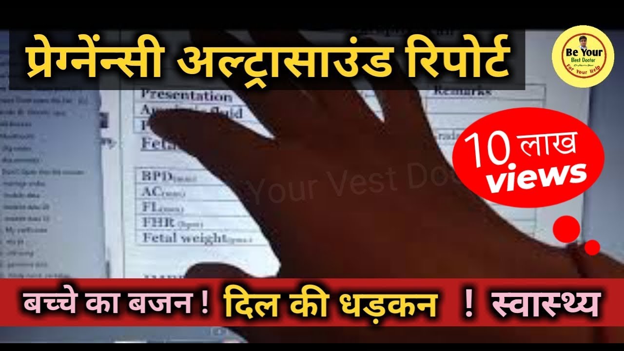 How To Read Pregnancy Ultrasounds (USG) At Home  | घर पर प्रेगनेन्सी अल्ट्रासाउंड कैसे देखें