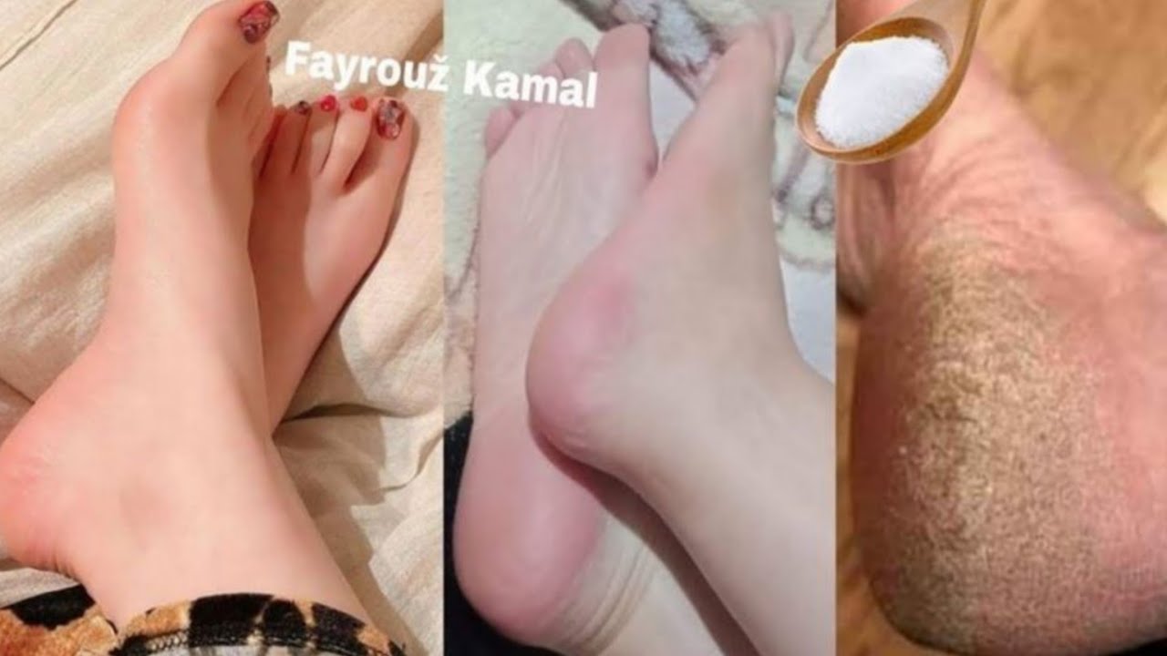معلقه واحد فقط هتقضي علي الخشونة والتشققات القدمين | بياض الثلج