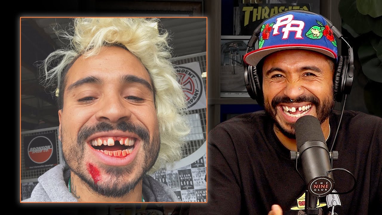 How Manny Santiago Lost His Tooth!