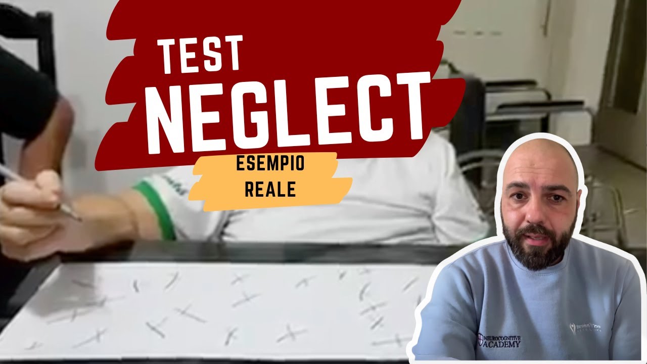 Test Neglect: esempio reale di ictus