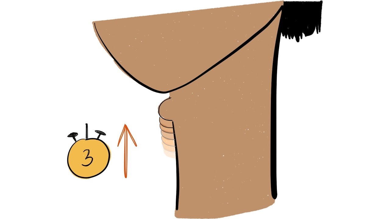 Mendelsohn Maneuver