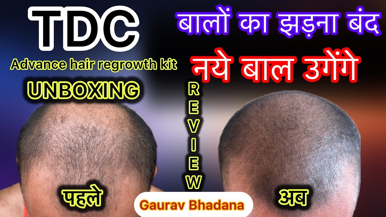Tdc advance hair growth kit review || unboxing || how to use tdc advance hair regrowth kit ||