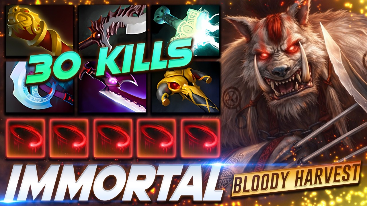 Bloodseeker 30 KILLS Hunter - Dota 2 Pro Gameplay [Watch & Learn]