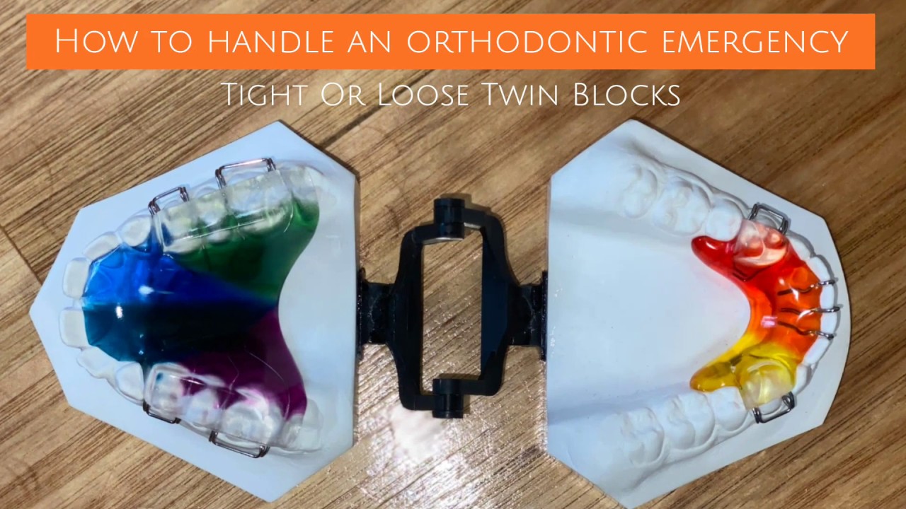Handling An Orthodontic Emergency: Tight or Loose Twin Blocks