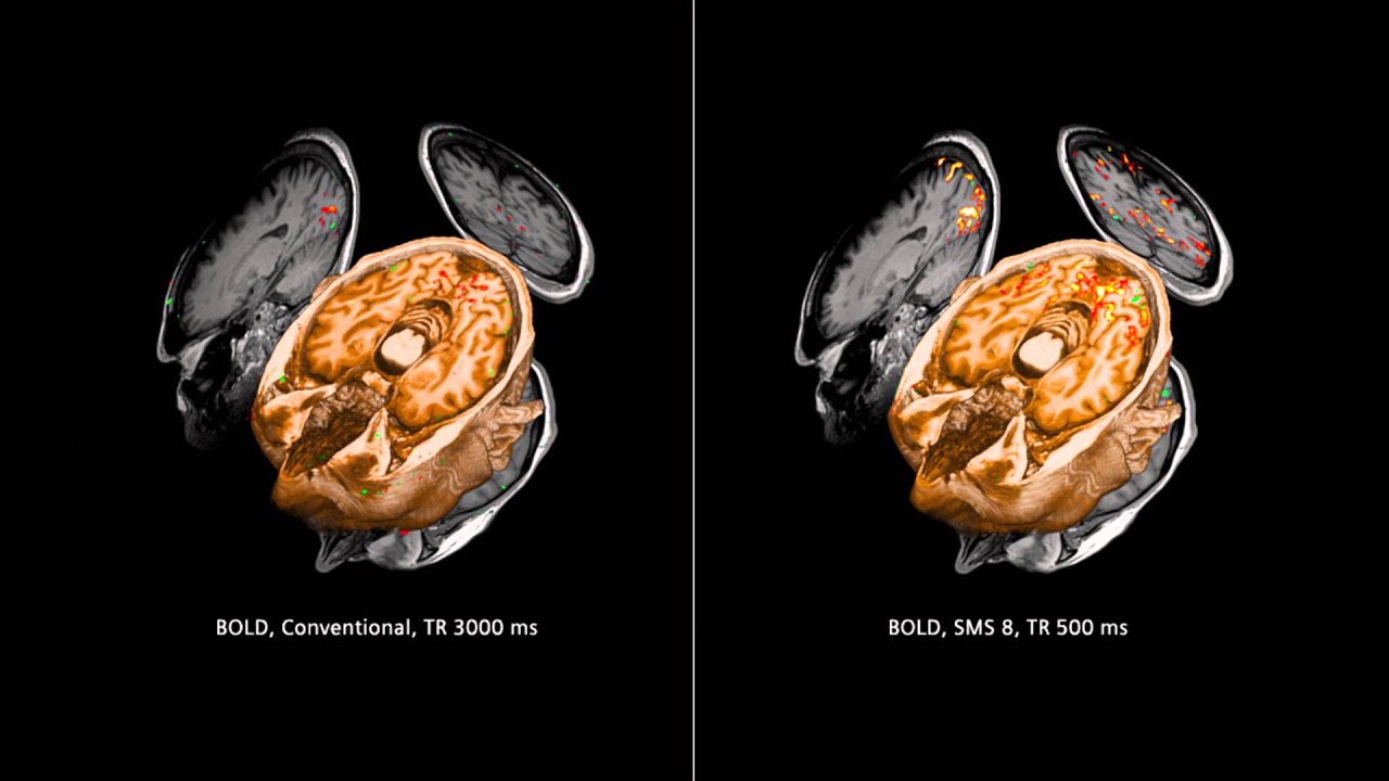 RSNA Technology Report 2015: MRI