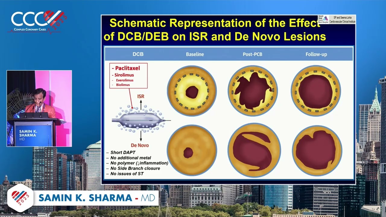 Samin K  Sharma, MD   Top Ten Advances of Interventional Cardiology 2025