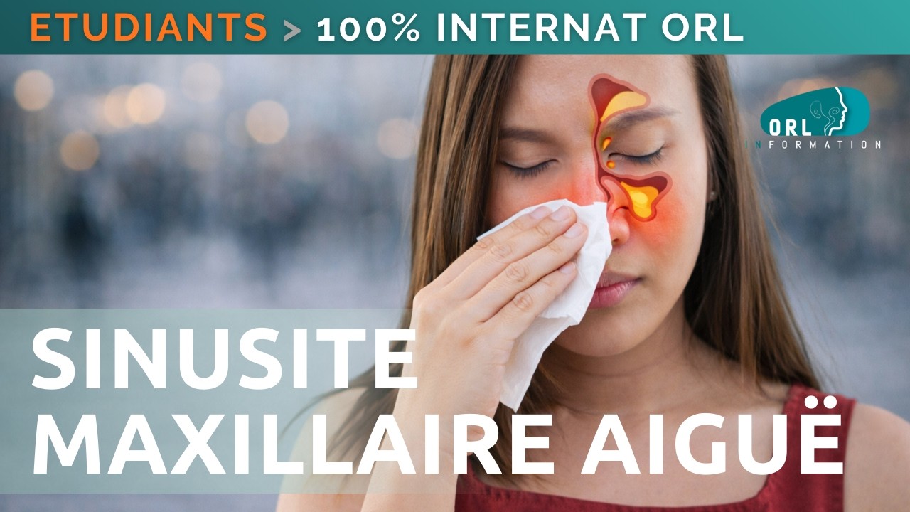 Sinusite Maxillaire Aiguë | 100% Internat ORL | Episode #2