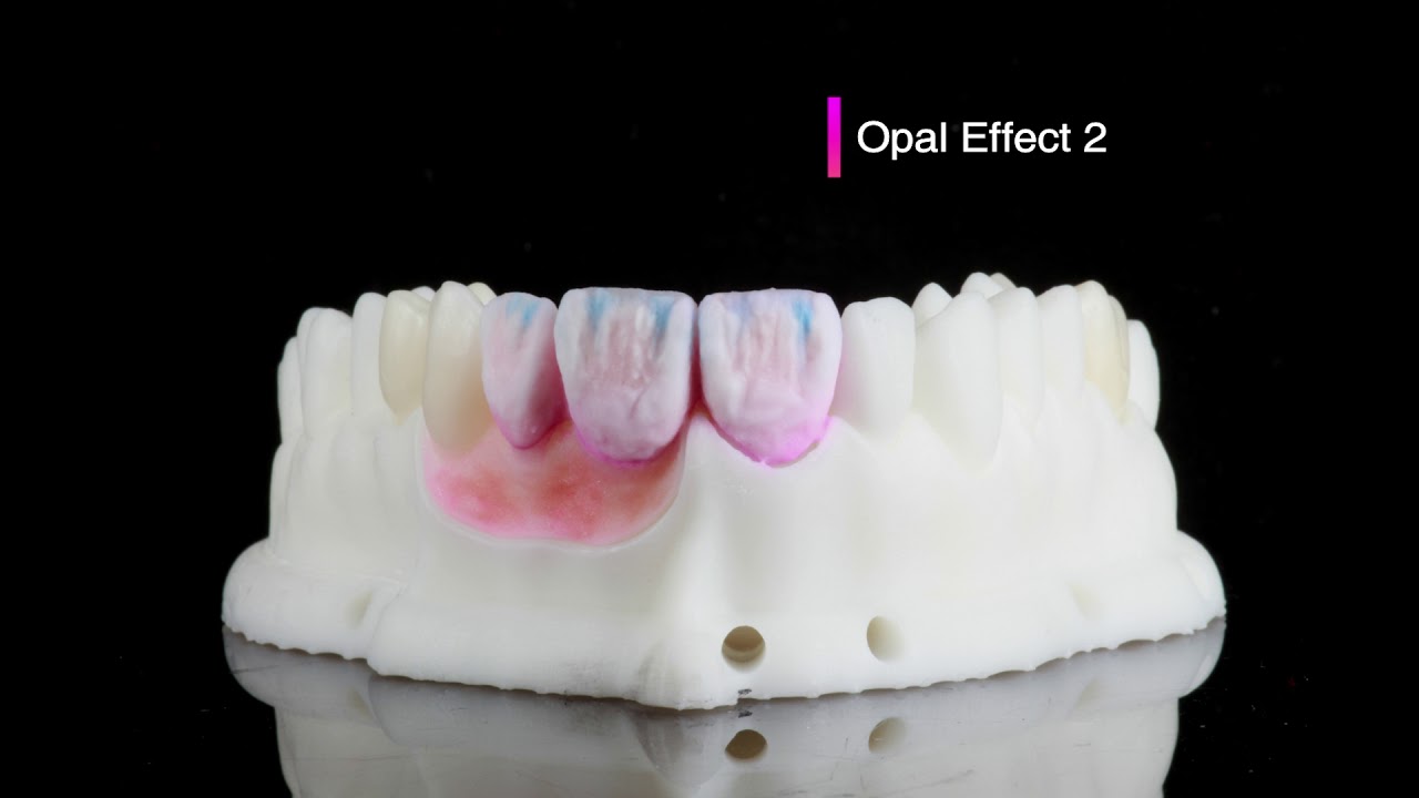 DORIOT DENT - IPS e.max ZirCAD MT multi - 