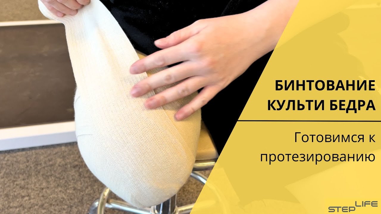 Бинтование культи | Перед протезированием | STEPLIFE
