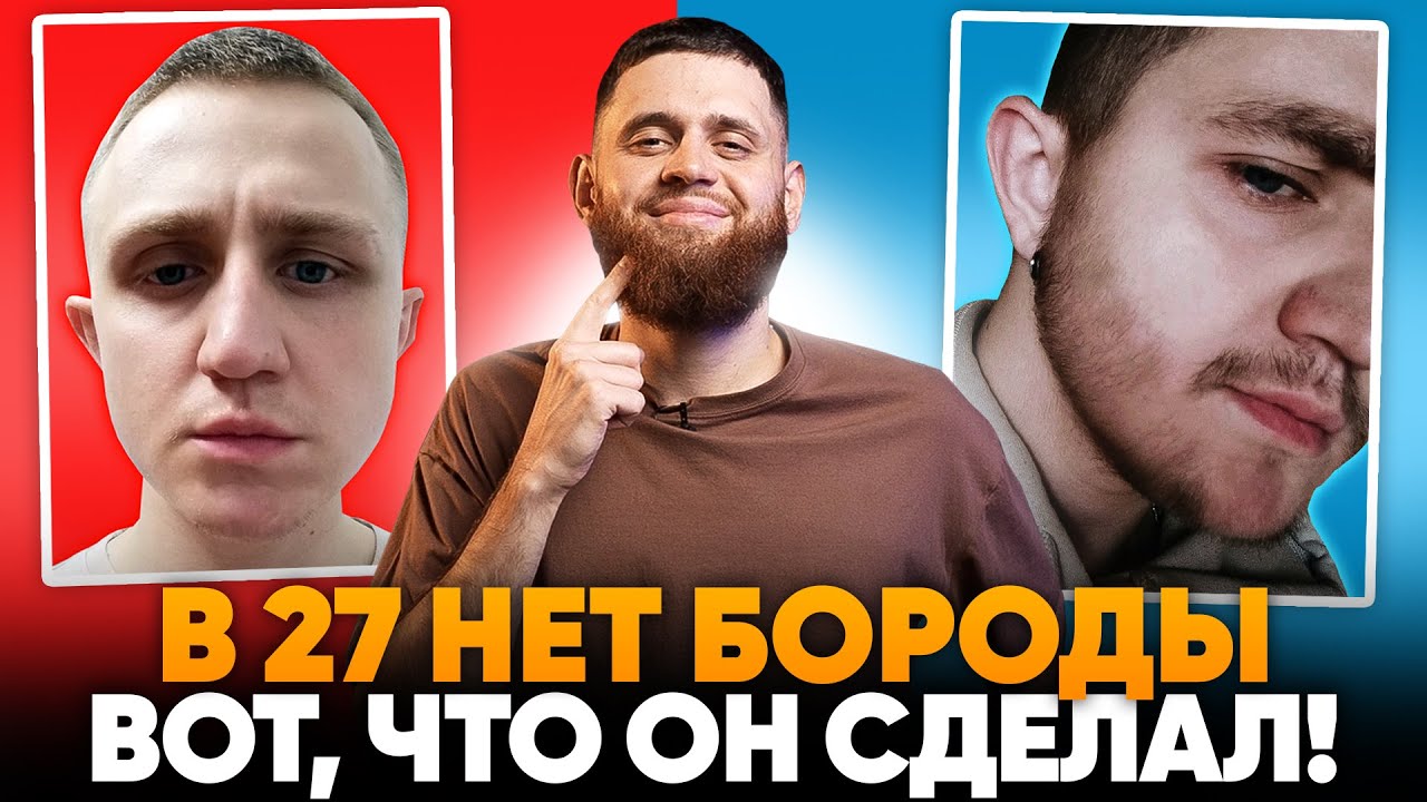 В 27 ЛЕТ не росла борода и В РОДУ все безбородые. Но помог ксиноксин!