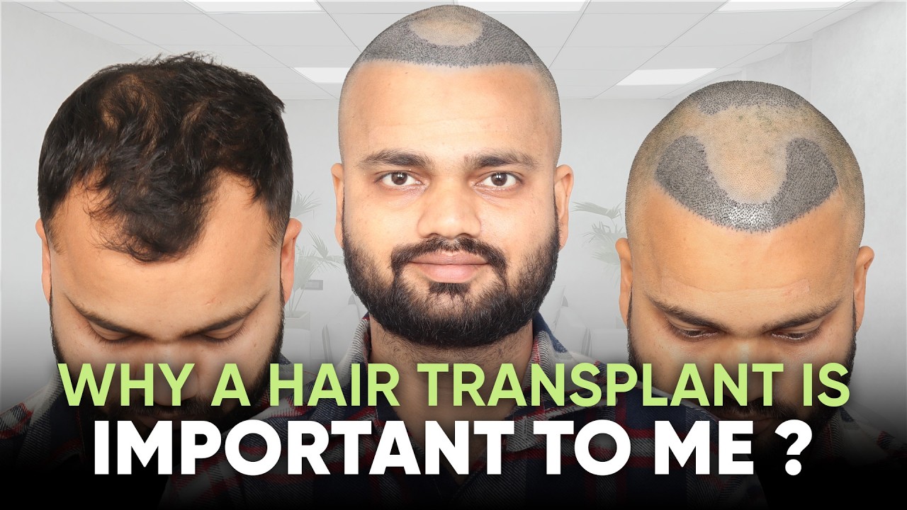 Hair Transplant in Kolkata (HX-QAAD) | Best Results & Cost of Hair Transplant in Kolkata